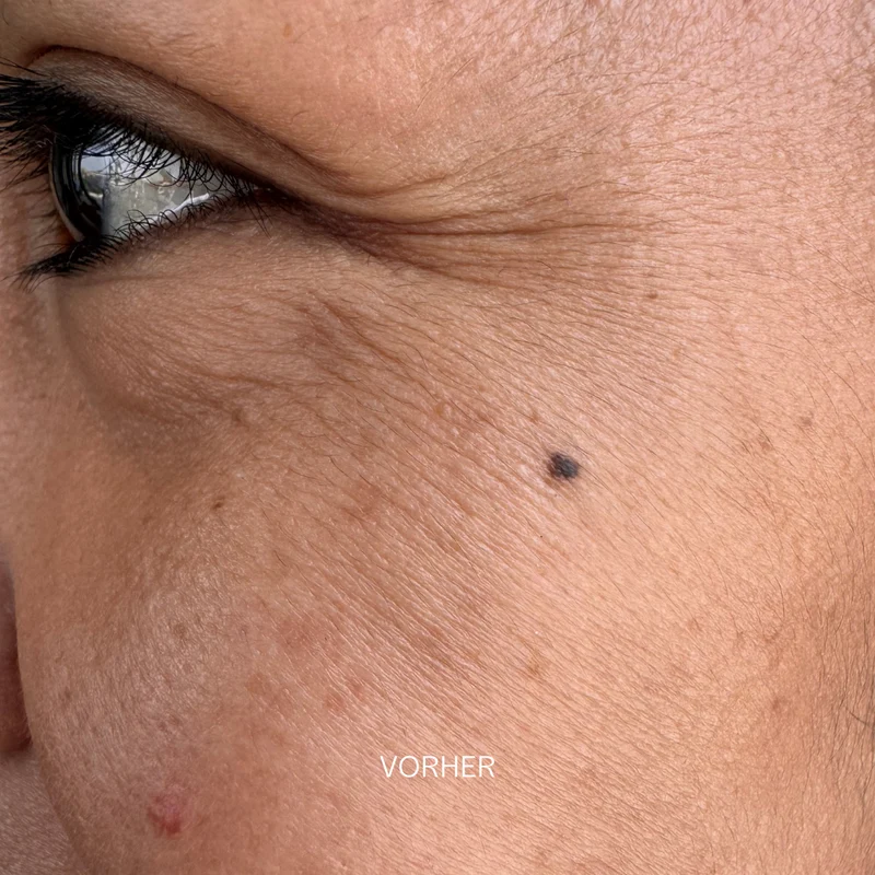 Green Beautox + Collagen Booster