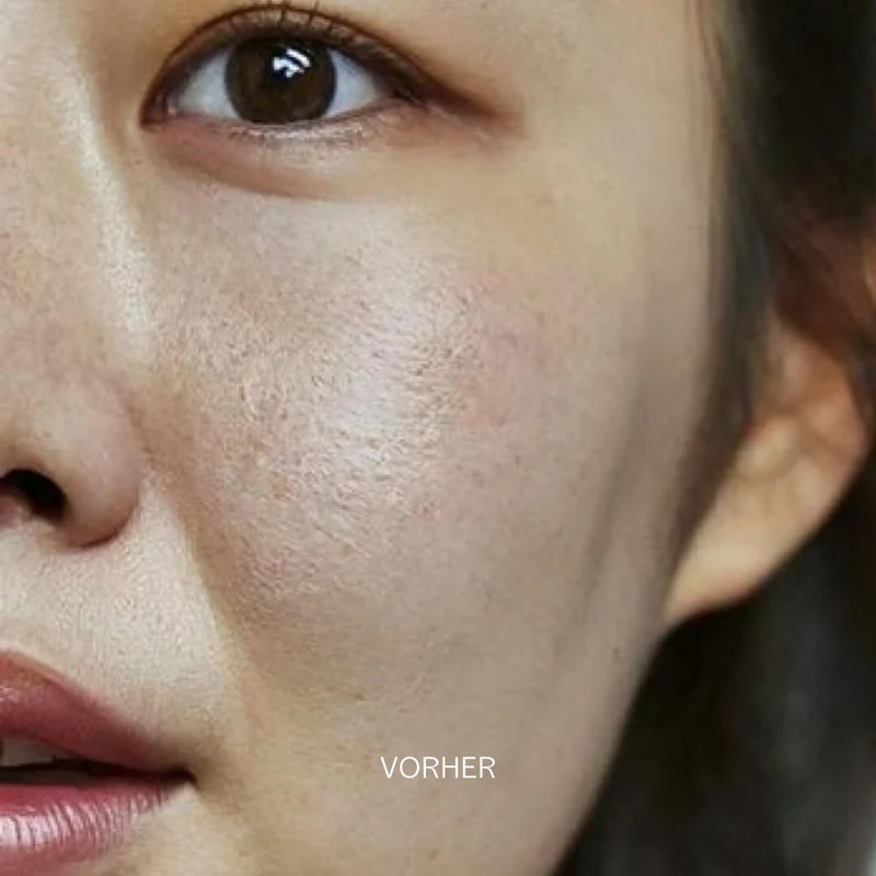 Green Hyaluronic + Peptide Booster