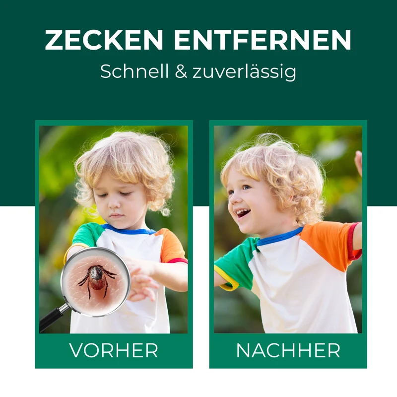 Zeckenfrei-Set - Dein Duo für Schutz & Entfernung