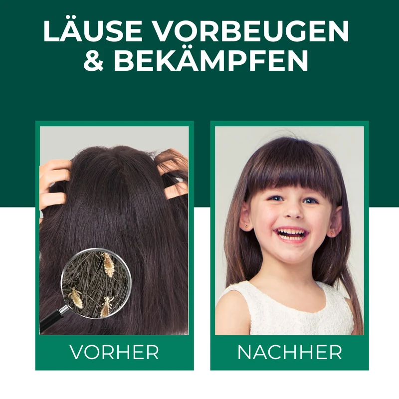 Kopfläusespray | Läuseabwehrspray Spray gegen Läuse / Kopfläuse